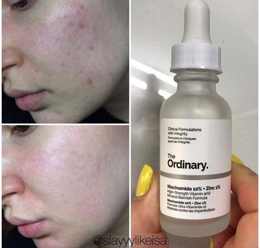 The Ordinary Niacinamide 10% + Zinc 1% Face Serum